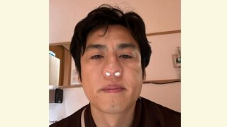 【ロバート】山本ひろしさん 副鼻腔炎「処置名」に困惑「開、大処置なのか？」手術は無事終了