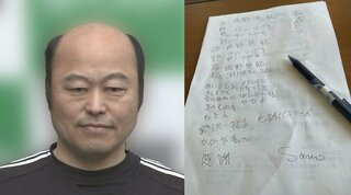 佐野慈紀さん　「字の練習　なかなか難しい」　右腕切断手術後の状況明かす